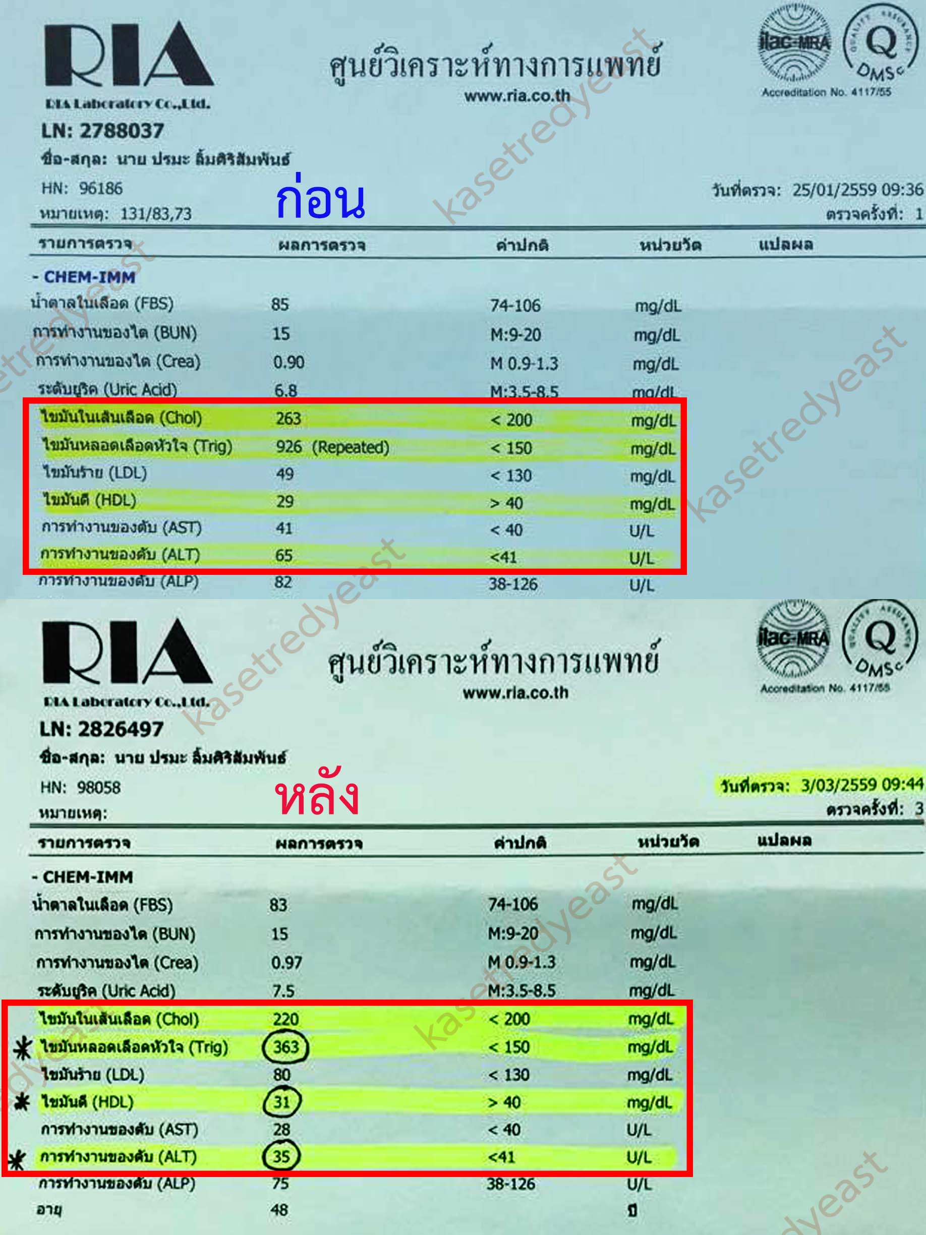 รีวิวกินข้าวยีสต์แดงม.เกษตร