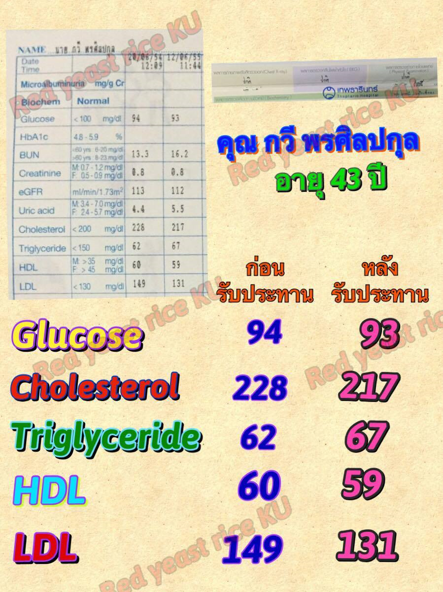 รีวิวกินข้าวยีสต์แดงม.เกษตร